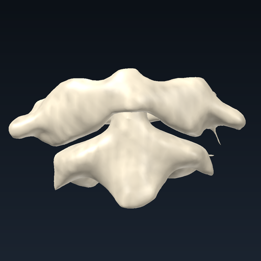 Atlas ve aksis (C1–C2)