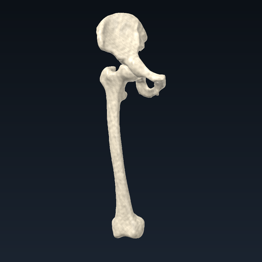 Kalça kemiği ve femur (sağ)