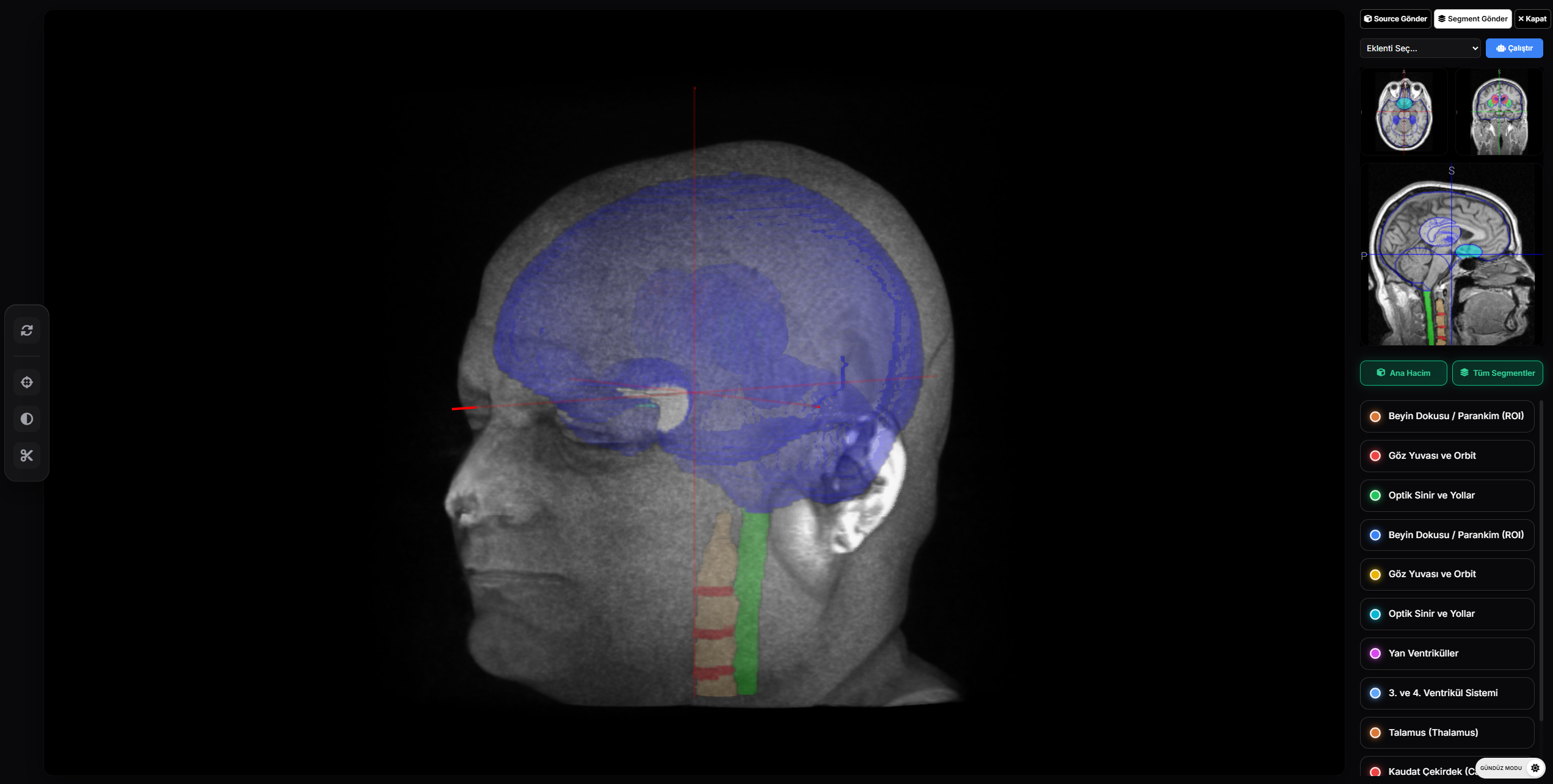 AI Brain MR Segmentation Viewer